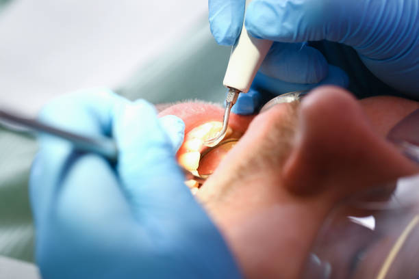 Best Emergency Tooth Extraction in Leonia, NJ