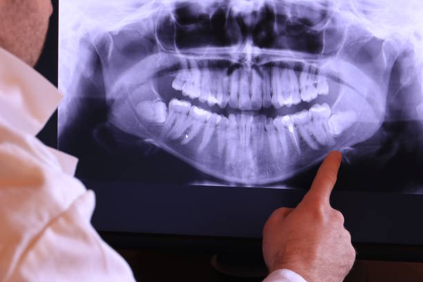 Best Emergency Broken Tooth Repair in Leonia, NJ